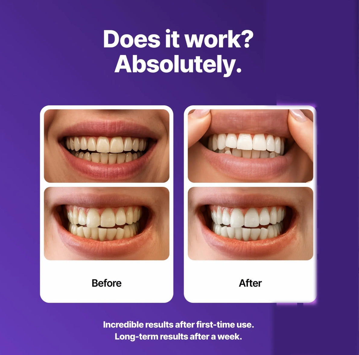 Teeth Whitening Strip Kit